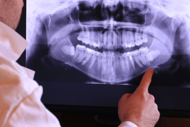 Best Emergency Dental Care for Trauma or Injury in Volo, IL
