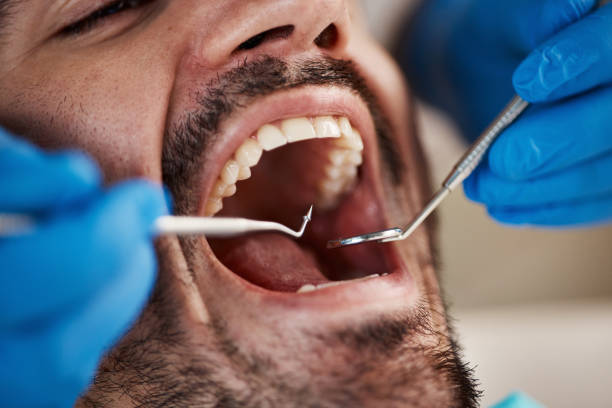 Best Emergency Treatment for Toothache in Volo, IL